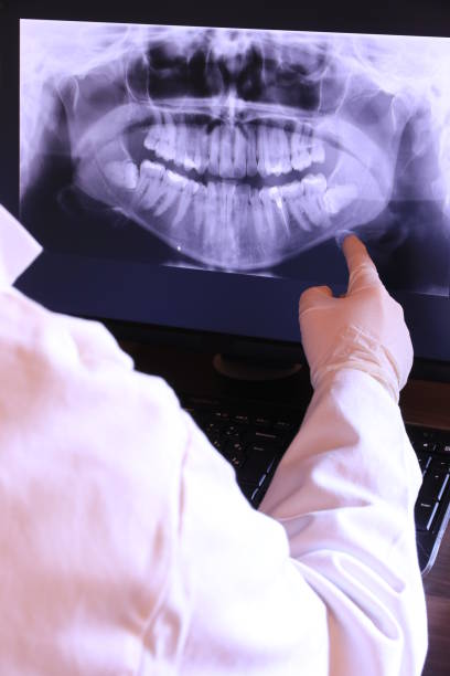 Best Broken or Cracked Tooth Emergency Dentist in Murrieta, CA